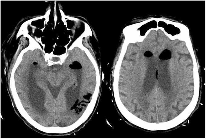 Fig. 2