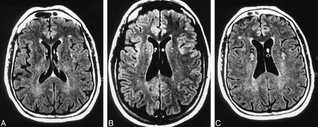 fig 3.