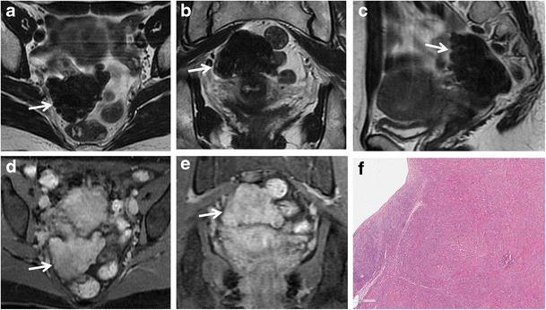 Fig. 17