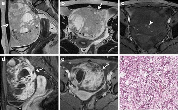 Fig. 15