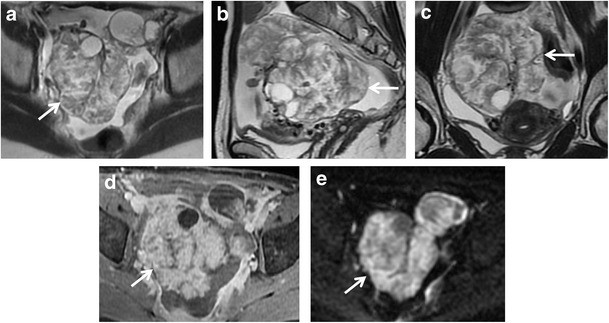 Fig. 10