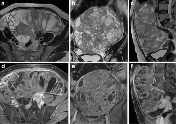 Fig. 11