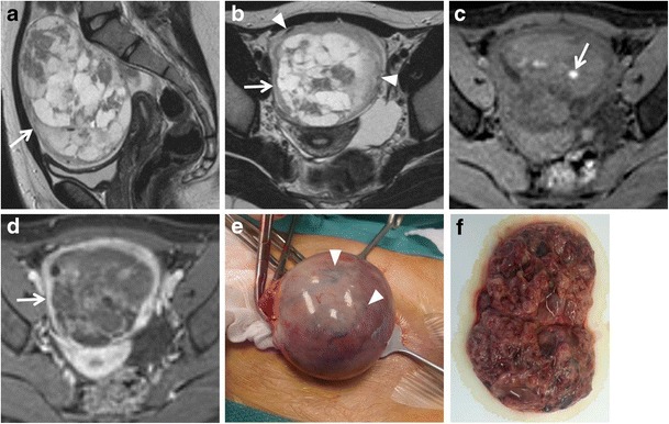 Fig. 18