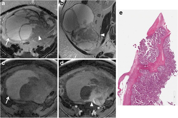 Fig. 13