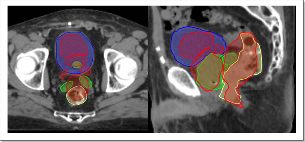 Figure 13