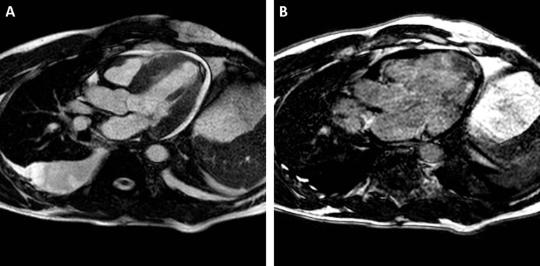 Figure 6