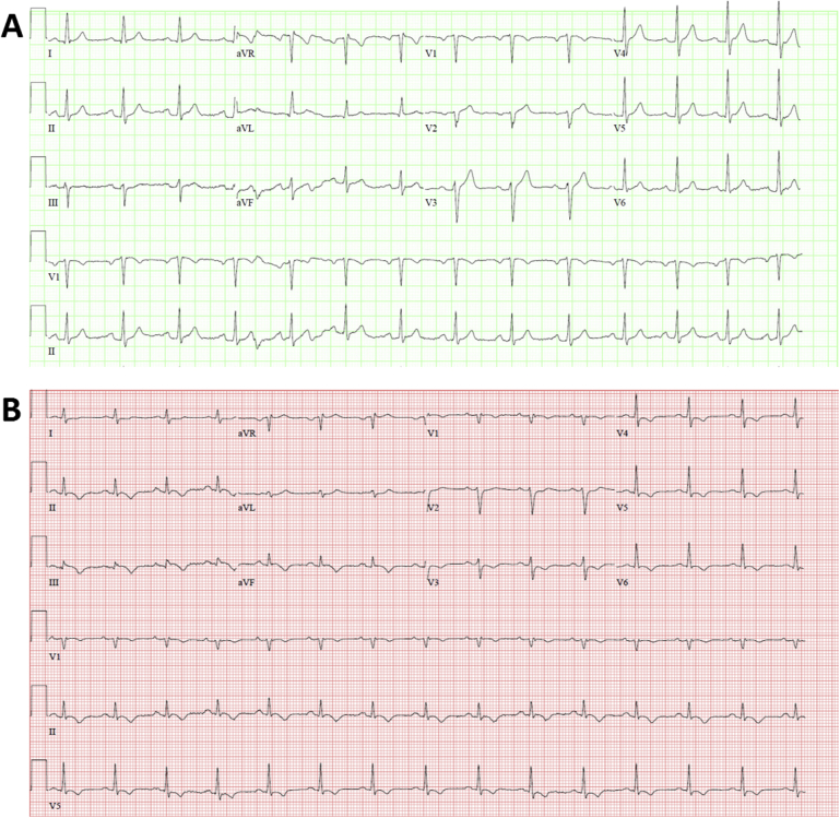 Figure 1