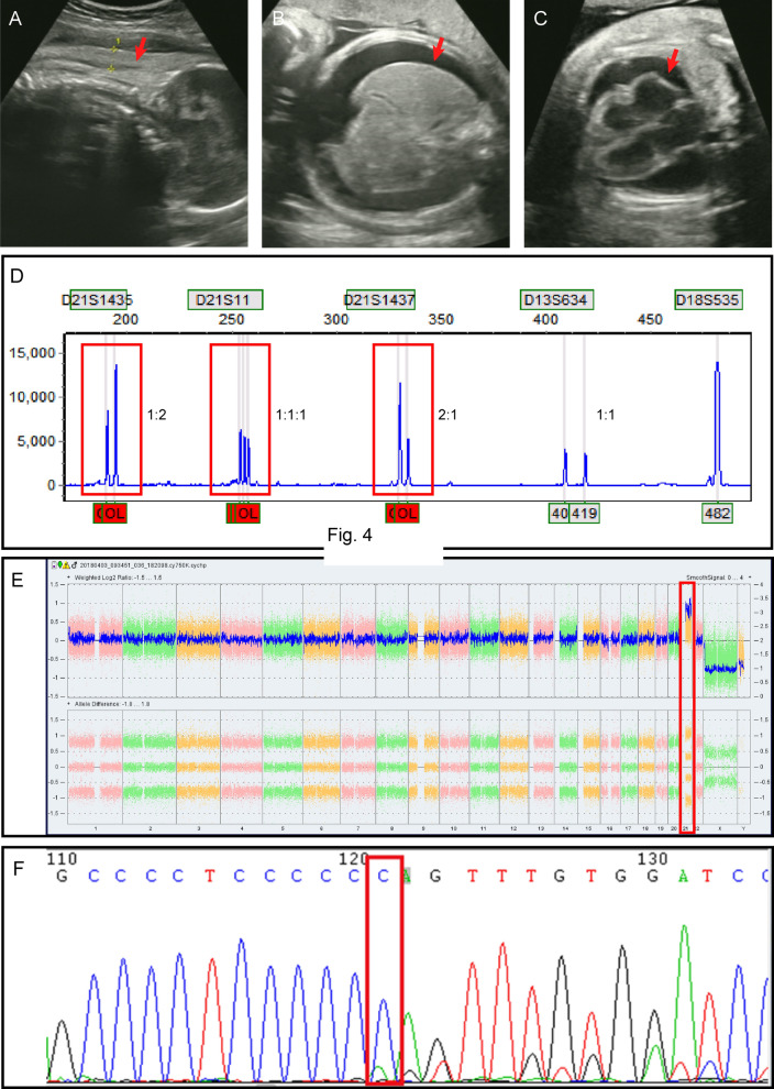Fig. 2