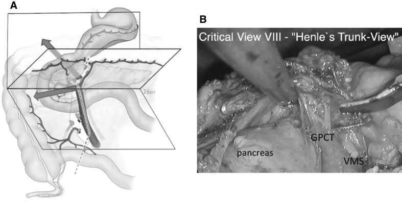 Fig. 9