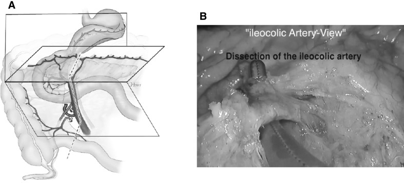 Fig. 5