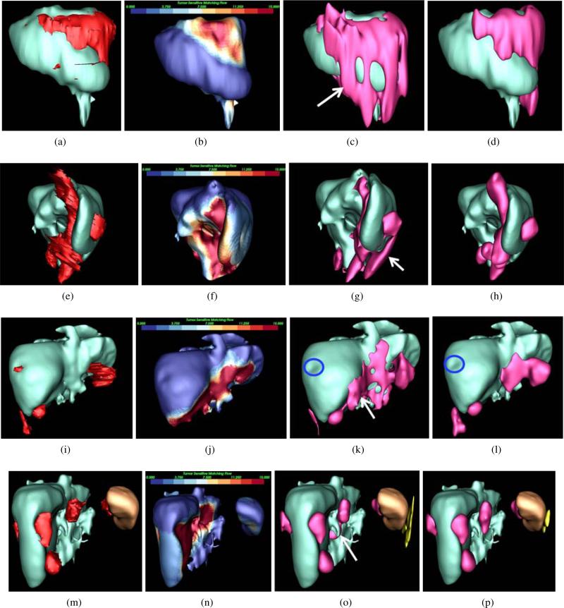 Figure 14