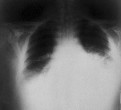 Figure 64.3