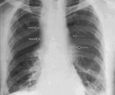 Figure 64.2