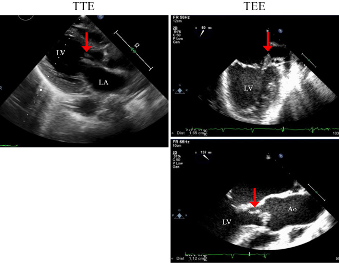 Figure 2.