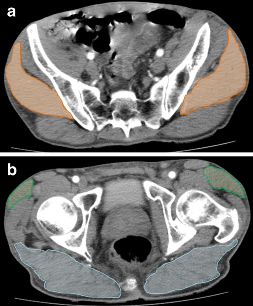 Fig. 1