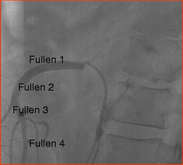 Fig. 2