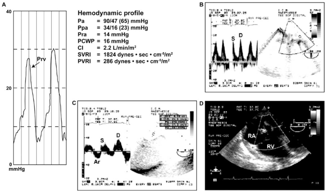 Fig. (4)