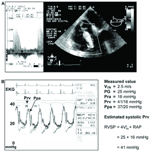 Fig. (1)