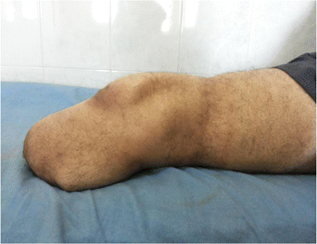 Fig. 11