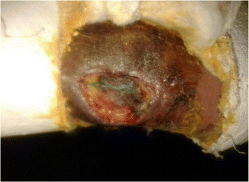 Fig. 14