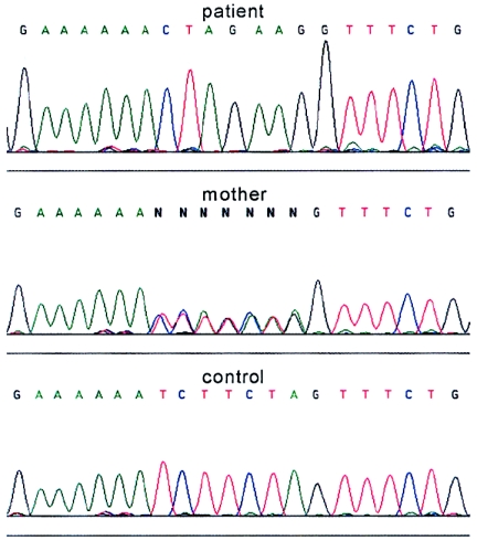 Figure  2