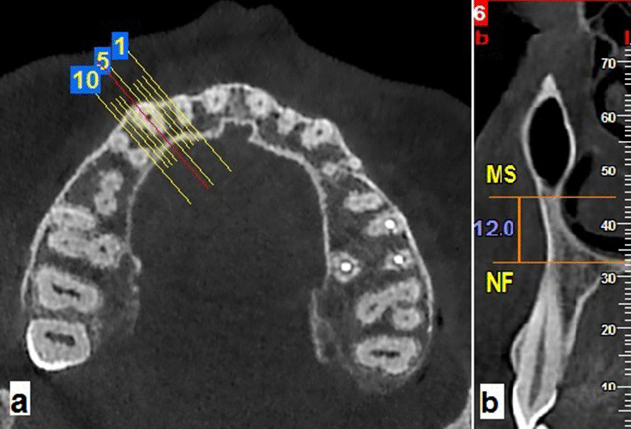 Fig. 4