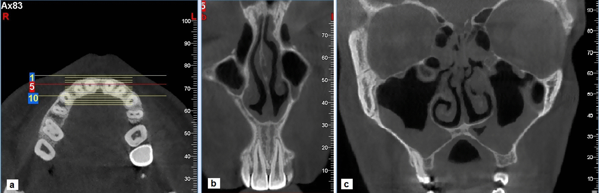Fig. 5