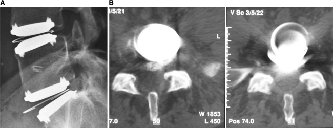 Fig. 4