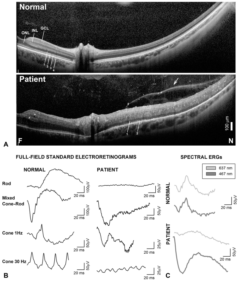 Fig. 2.