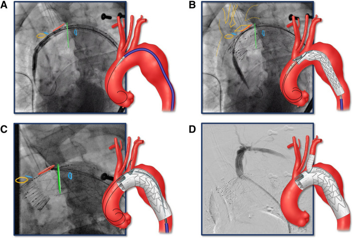 Fig. 2