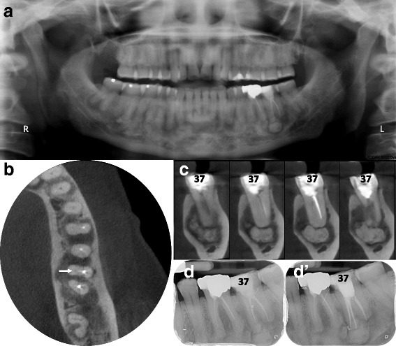 Fig. 2