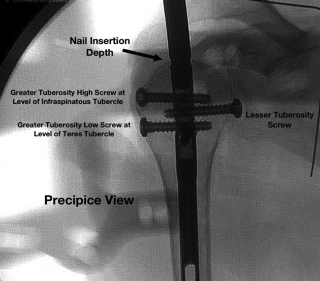 Figure 3