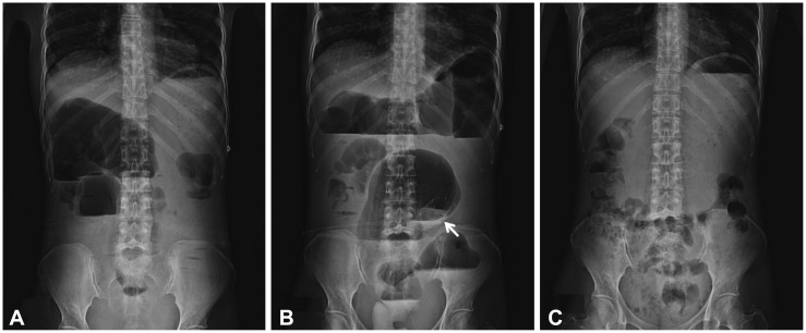 Fig. 1