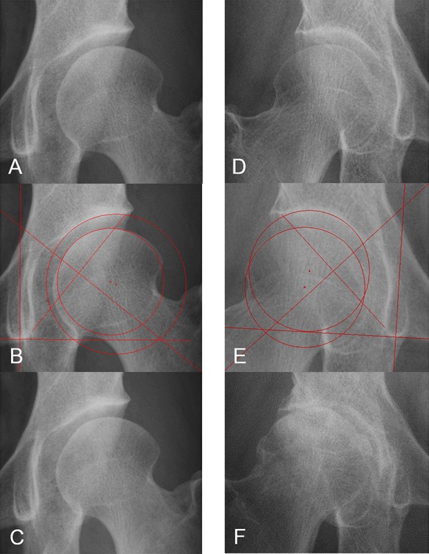 Fig. 4 A-F