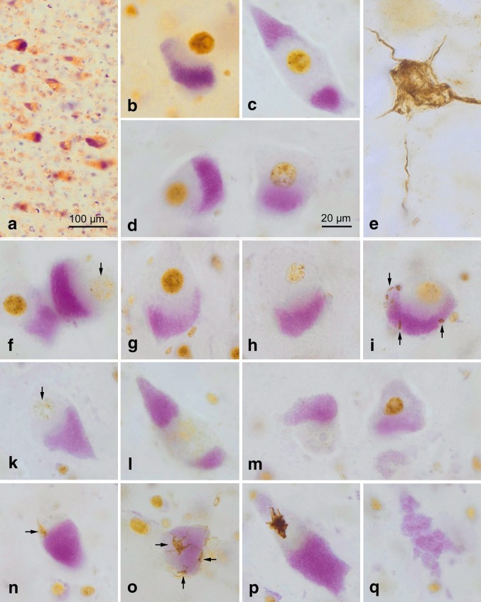 Fig. 1