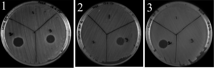 FIG 1