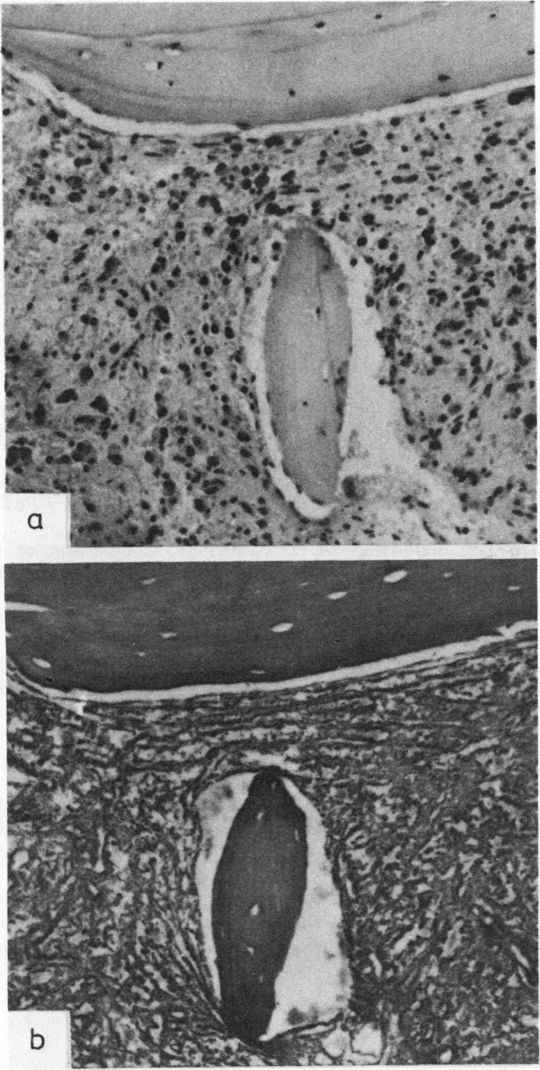 graphic file with name jclinpath00516-0011-a.jpg