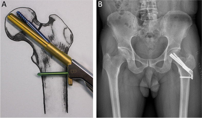 Fig. 7