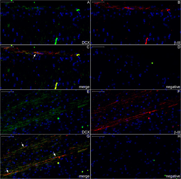 Figure 22