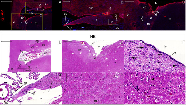 Figure 23