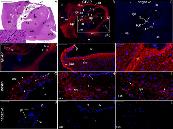 Figure 30