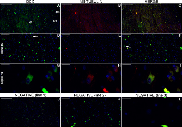 Figure 21