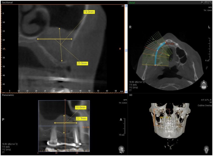 Figure 6