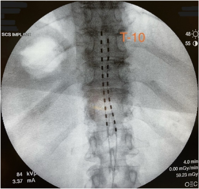 Fig. 1