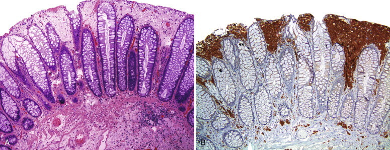 Figure 23-2 ▪