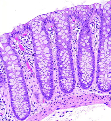 Figure 23-1 ▪