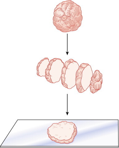 Figure 23-10 ▪