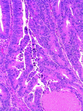 Figure 23-5 ▪