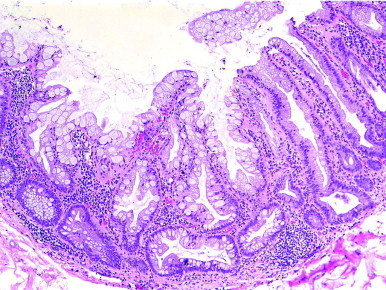 Figure 23-21 ▪