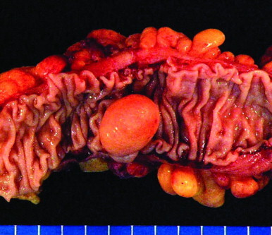 Figure 23-37 ▪